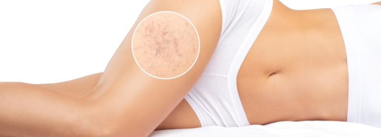 <h1>Micro-r�cup�ration : la nouvelle m�thode des sportifs pour �viter la fatigue chronique</h1>